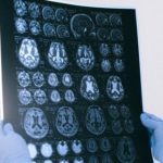 The Month Of June Is Alzheimer’s And Brain Awareness Month